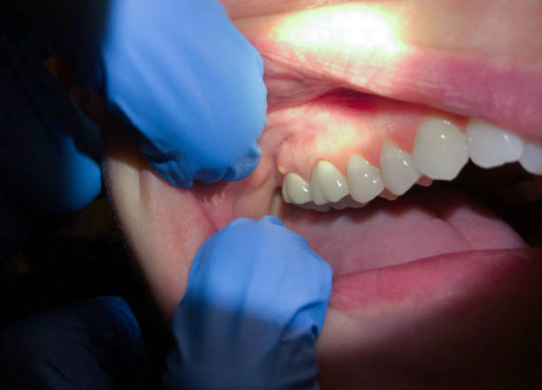 Best Emergency Dental Services for Seniors in Spanish Fork, UT