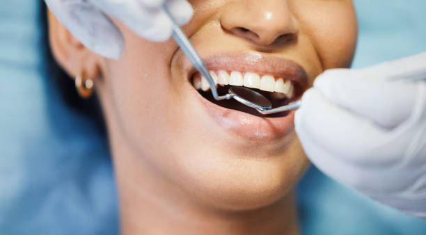 Best Emergency Dentist for Lost Fillings or Crowns in Spanish Fork, UT